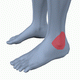 MG: ankle joint; mortise joint
